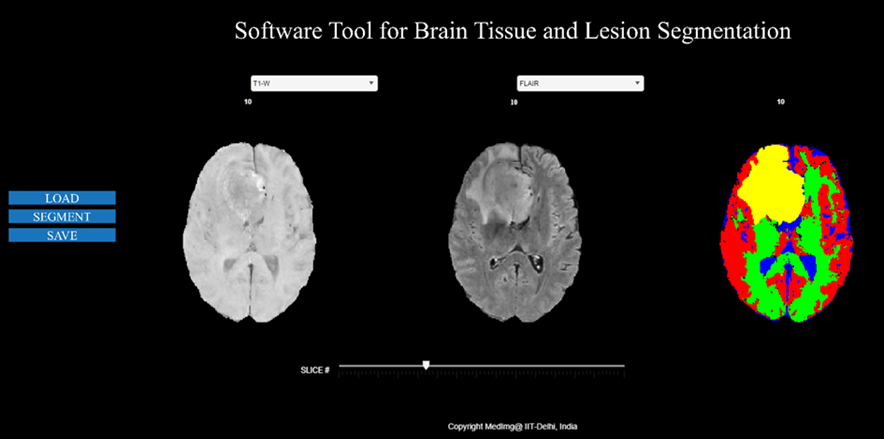 Automatic Multiclass Tissue Segmentation using Deep Learning in Brain ...